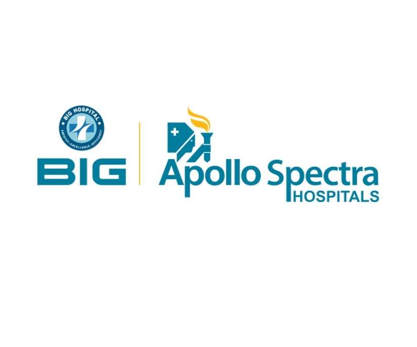 Big Apollo Spectra