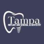 Tampa Implant General Dentistry General Dentistry